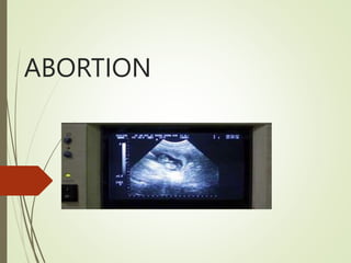 ABORTION
 
