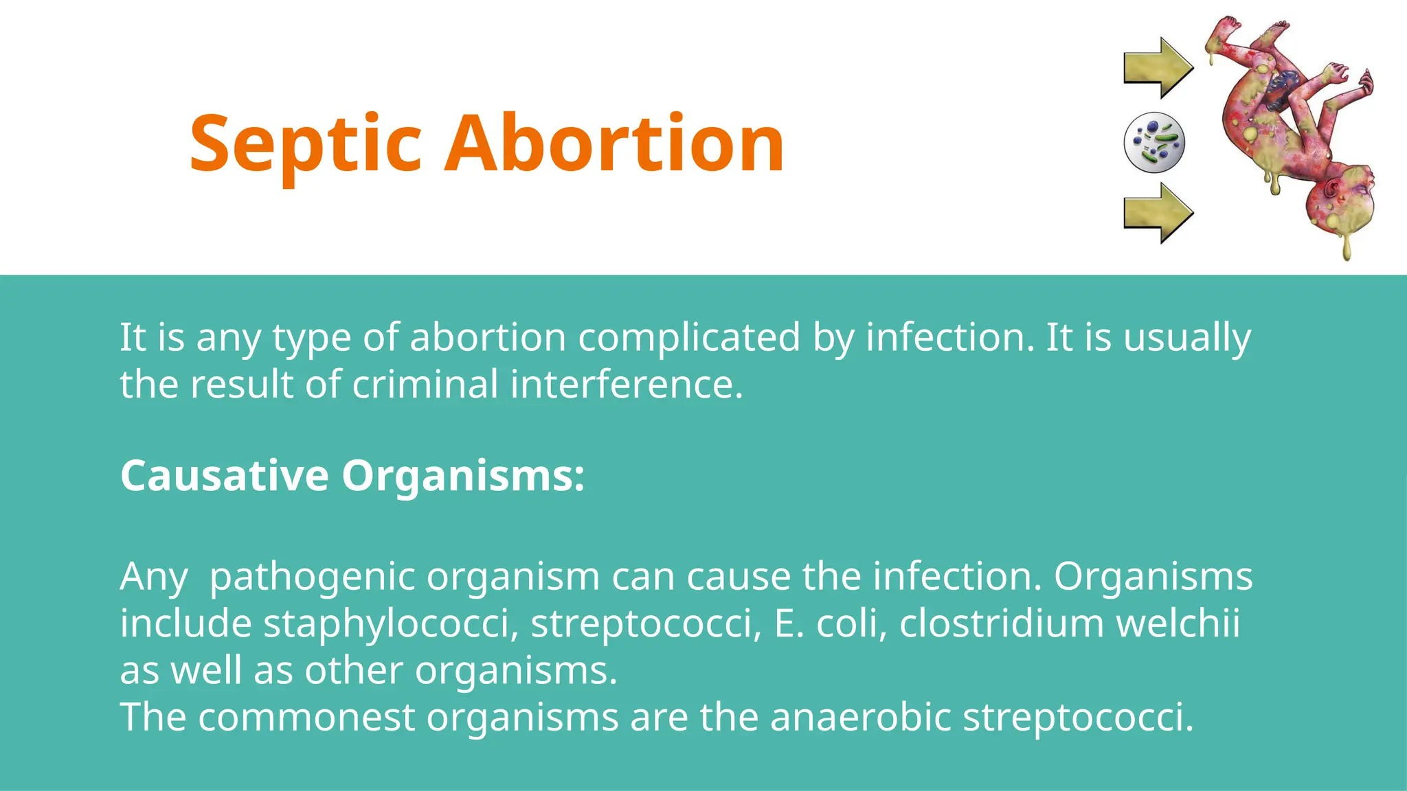 Septic Abortion
It is any type of abortion complicated by infection. It is usually
the result of criminal interference.
Causative Organisms:
Any pathogenic organism can cause the infection. Organisms
include staphylococci, streptococci, E. coli, clostridium welchii
as well as other organisms.
The commonest organisms are the anaerobic streptococci.
 