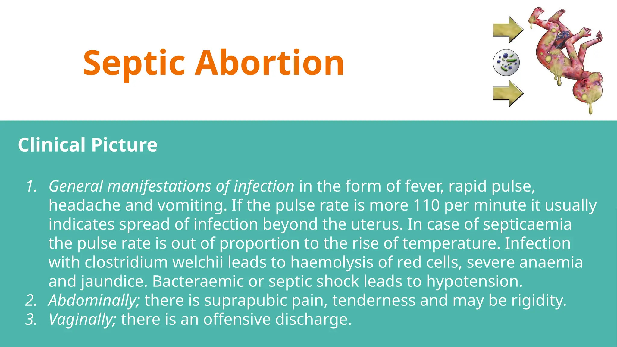 Septic Abortion
Clinical Picture
1. General manifestations of infection in the form of fever, rapid pulse,
headache and vomiting. If the pulse rate is more 110 per minute it usually
indicates spread of infection beyond the uterus. In case of septicaemia
the pulse rate is out of proportion to the rise of temperature. Infection
with clostridium welchii leads to haemolysis of red cells, severe anaemia
and jaundice. Bacteraemic or septic shock leads to hypotension.
2. Abdominally; there is suprapubic pain, tenderness and may be rigidity.
3. Vaginally; there is an offensive discharge.
 