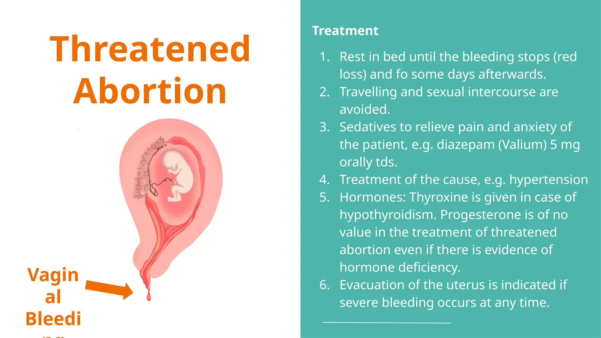 Threatened
Abortion
Vagin
al
Bleedi
Treatment
1. Rest in bed until the bleeding stops (red
loss) and fo some days afterwards.
2. Travelling and sexual intercourse are
avoided.
3. Sedatives to relieve pain and anxiety of
the patient, e.g. diazepam (Valium) 5 mg
orally tds.
4. Treatment of the cause, e.g. hypertension
5. Hormones: Thyroxine is given in case of
hypothyroidism. Progesterone is of no
value in the treatment of threatened
abortion even if there is evidence of
hormone deficiency.
6. Evacuation of the uterus is indicated if
severe bleeding occurs at any time.
 