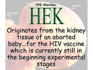293 Abortion




Originates from the kidney
   tissue of an aborted
baby...for the HIV vaccine
 which is currently still in
the beginning experimental
           stages
 