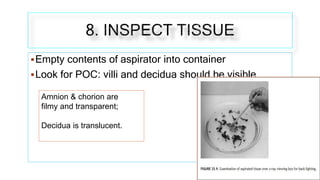 Empty contents of aspirator into container
Look for POC: villi and decidua should be visible
Amnion & chorion are
filmy ...