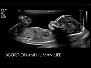 ABORTION and HUMAN LIFE
 