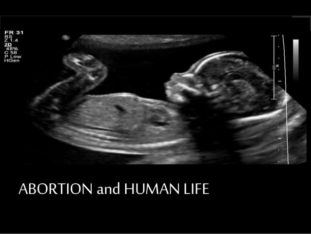 abortion and the termination of human life Published: mon, 5 dec 2016 an abortion refers to the “premature termination of a pregnancy” (thiroux & krasemann 2009, p254) many ethical issues arise from abortion, however the main one’s to be discussed are regarding whether or not abortion is considered the taking of human life, and whose decision is it to determine whether or not they should be permitted. abortion and the termination of human life Published: mon, 5 dec 2016 an abortion refers to the “premature termination of a pregnancy” (thiroux & krasemann 2009, p254) many ethical issues arise from abortion, however the main one’s to be discussed are regarding whether or not abortion is considered the taking of human life, and whose decision is it to determine whether or not they should be permitted.