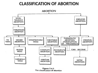 ABORTION CLASS NOTES. The definition, cause and management | PPTX