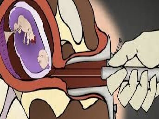 abortion-forensic-medicine-ppt