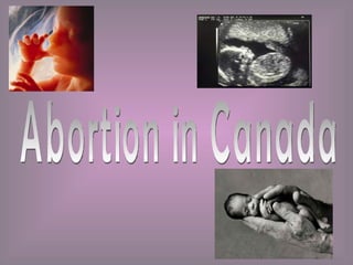 Abortion in Canada 