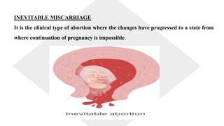 abortion new 1.pptx
