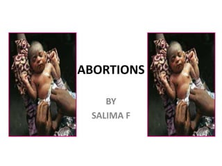 ABORTIONS
BY
SALIMA F
 