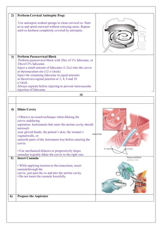 Paracervical Injection Abortions.pdf