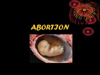 ABORTION
 