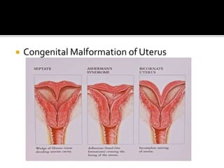  Congenital Malformation of Uterus
 
