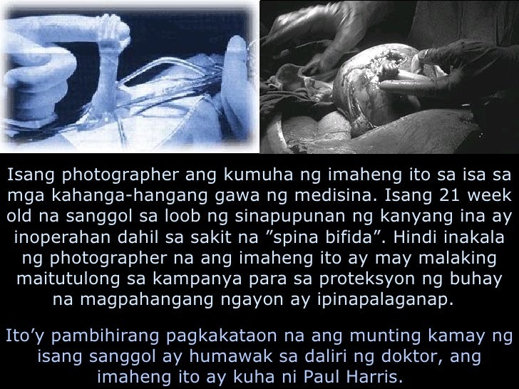 😂 Thesis ng aborsyon. Thesis Filipino 2 Tungkol Sa Aborsyon Free Essays