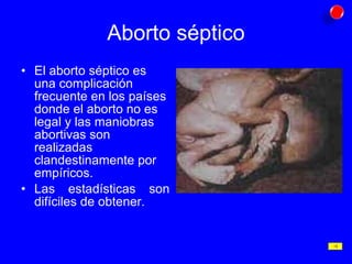 Aborto séptico El aborto séptico es una complicación frecuente en los países donde el aborto no es legal y las maniobras abortivas son realizadas clandestinamente por empíricos. Las estadísticas son difíciles de obtener. 