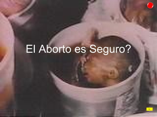 El Aborto es Seguro? 