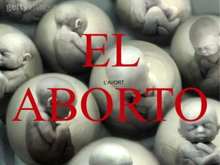 L'AVORT EL ABORTO 