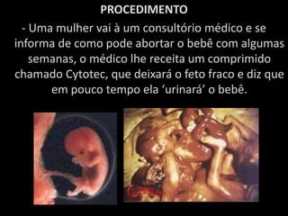 PROCEDIMENTO- Uma mulher vai à um consultório médico e se informa de como pode abortar o bebê com algumas semanas, o médico lhe receita um comprimido chamado Cytotec, que deixará o feto fraco e diz que em pouco tempo ela ‘urinará’ o bebê.