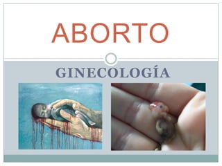 ABORTO ginecología 