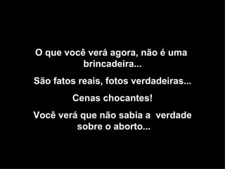 O que você verá agora, não é uma  brincadeira... São fatos reais, fotos verdadeiras... Cenas chocantes! Você verá que não sabia a  verdade  sobre o aborto... 