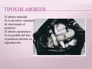 TIPOS DE ABORTOS
El aborto inducido
Es la decisión voluntaria
de interrumpir al
producto
El aborto espontaneo ;
Es la perdida del feto o
el producto durante su
reproducción
 