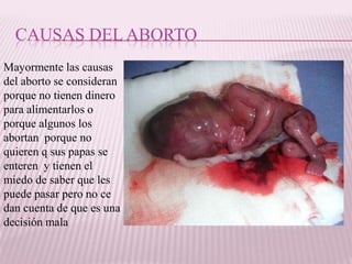 CAUSAS DEL ABORTO
Mayormente las causas
del aborto se consideran
porque no tienen dinero
para alimentarlos o
porque algunos los
abortan porque no
quieren q sus papas se
enteren y tienen el
miedo de saber que les
puede pasar pero no ce
dan cuenta de que es una
decisión mala
 