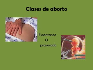 Clases de aborto



    Espontaneo
        O
     provocado
 
