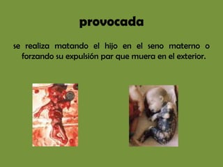 provocada
se realiza matando el hijo en el seno materno o
  forzando su expulsión par que muera en el exterior.
 