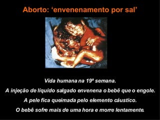 Vida humana na 19ª semana. A injeção de líquido salgado envenena o bebê que o engole. A pele fica queimada pelo elemento cáustico. O bebê sofre mais de uma hora e morre lentamente. Aborto: ‘envenenamento por sal’ 