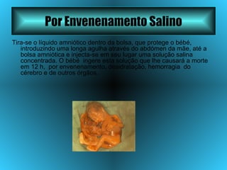 Por Envenenamento Salino Tira-se o líquido amniótico dentro da bolsa, que protege o bébé, introduzindo uma longa agulha através do abdómen da mãe, até a bolsa amniótica e injecta-se em seu lugar uma solução salina concentrada. O bébé  ingere esta solução que lhe causará a morte em 12 h,  por envenenamento, desidratação, hemorragia  do cérebro e de outros órgãos. 