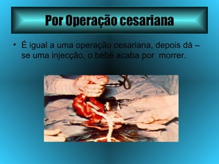 Por Operação cesariana É igual a uma operação cesariana, depois dá –se uma injecção, o bébé acaba por  morrer. 