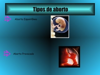 Tipos de aborto Aborto Provocado   Aborto Espontâneo   