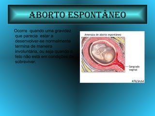 Aborto Espontâneo Ocorre  quando uma gravidez que parecia  estar a desenvolver-se normalmente termina de maneira involuntária, ou seja quando o feto não está em condições de sobreviver. 