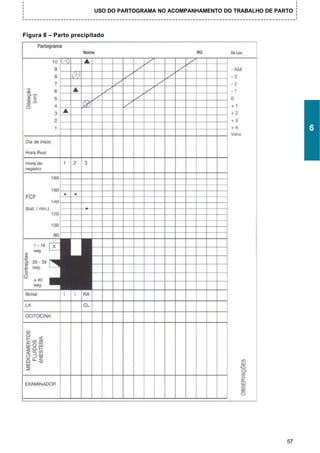 USO DO PARTOGRAMA NO ACOMPANHAMENTO DO TRABALHO DE PARTO



Figura 8 – Parto precipitado




                                                                                   6




                                                                              57
 