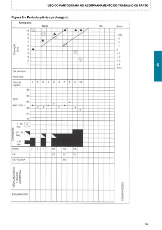 USO DO PARTOGRAMA NO ACOMPANHAMENTO DO TRABALHO DE PARTO



Figura 9 – Período pélvico prolongado




                                                                                  6




                                                                             59
 