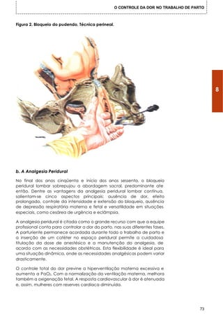 O CONTROLE DA DOR NO TRABALHO DE PARTO



Figura 2. Bloqueio do pudendo. Técnica perineal.




                                                                                            8




b. A Analgesia Peridural

No final dos anos cinqüenta e início dos anos sessenta, o bloqueio
peridural lombar sobrepujou a abordagem sacral, predominante ate
então. Dentre as vantagens da analgesia peridural lombar contínua,
salientam-se cinco aspectos principais: ausência de dor, efeito
prolongado, controle da intensidade e extensão do bloqueio, ausência
de depressão respiratória materna e fetal e versatilidade em situações
especiais, como cesárea de urgência e eclâmpsia.

A analgesia peridural é citada como o grande recurso com que a equipe
profissional conta para controlar a dor do parto, nas suas diferentes fases.
A parturiente permanece acordada durante todo o trabalho de parto e
a inserção de um catéter no espaço peridural permite a cuidadosa
titulação da dose de anestésico e a manutenção do analgesia, de
acordo com as necessidades obstétricas. Esta flexibilidade é ideal para
uma situação dinâmica, onde as necessidades analgésicas podem variar
drasticamente.

O controle total do dor previne a hiperventilação materna excessiva e
aumenta a PaO2. Com a normalização da ventilação materna, melhora
também a oxigenação fetal. A resposta cardiovascular à dor é atenuada
e, assim, mulheres com reserves cardíaca diminuída.




                                                                                       73
 