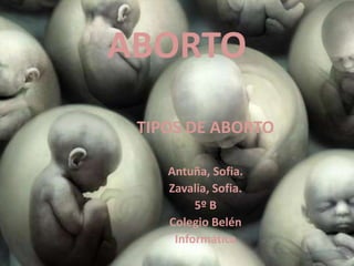 ABORTO
 TIPOS DE ABORTO

    Antuña, Sofia.
    Zavalia, Sofia.
         5º B
    Colegio Belén
     Informática
 