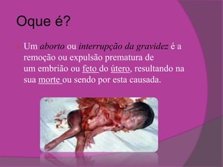 Oque é?
   Um aborto ou interrupção da gravidez é a
    remoção ou expulsão prematura de
    um embrião ou feto do útero, resultando na
    sua morte ou sendo por esta causada.
 