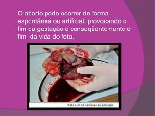    O aborto pode ocorrer de forma
    espontânea ou artificial, provocando o
    fim da gestação e conseqüentemente o
    fim da vida do feto.
 