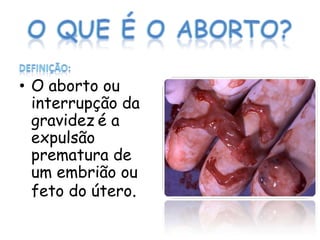 • O aborto ou
  interrupção da
  gravidez é a
  expulsão
  prematura de
  um embrião ou
  feto do útero.
 