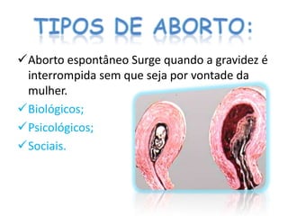 Aborto espontâneo Surge quando a gravidez é
 interrompida sem que seja por vontade da
 mulher.
Biológicos;
Psicológicos;
Sociais.
 