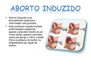  Aborto Induzido é um
  procedimento usado para
  interromper uma gravidez.
 Pode acontecer quando existem
  malformações congénitas,
  quando a gravidez resulta de um
  crime sexual, quando a gravidez
  coloca em perigo a vida e a saúde
  física ou psíquica da mulher ou
  simplesmente por opção da
  mulher.
 