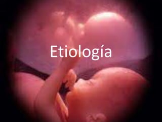 Etiología
 