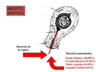 Miometrio
ABORTO
SEPTICO                      Embrión




                            Córion



                           Canal




                  Cuello

   Bacterias de
    la vagina:
                                        Material contaminado:
                                        Sonda Nélaton (60-80%)
                                        Lavado jabonoso (9-20%)
                                        Tallos vegetales (4-10%)
                                        Legrado Uterino (4-6%)
 