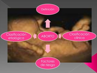 ABORTO
Definición
Clasificación
clínica
Factores
de riesgo
Clasificación
etiológica
 