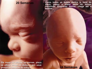 20 Semanas
24 Semanas
Como todos os bebês dentro (e fora) do
útero, passa a maior parte do tempo
dormindo. Enquanto dorme, chega até a
sonhar...
Ele mexe os braços, as pernas, piscaEle mexe os braços, as pernas, pisca
os olhos, chupa os dedos e tem seusos olhos, chupa os dedos e tem seus
primeiros acessos de soluço.primeiros acessos de soluço.
 