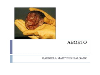 ABORTO

GABRIELA MARTINEZ SALGADO

 