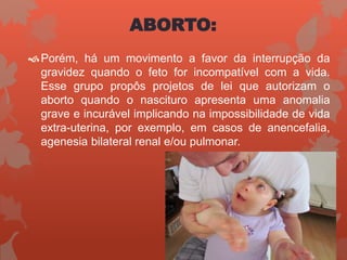 ABORTO:
Porém, há um movimento a favor da interrupção da
gravidez quando o feto for incompatível com a vida.
Esse grupo propôs projetos de lei que autorizam o
aborto quando o nascituro apresenta uma anomalia
grave e incurável implicando na impossibilidade de vida
extra-uterina, por exemplo, em casos de anencefalia,
agenesia bilateral renal e/ou pulmonar.
 