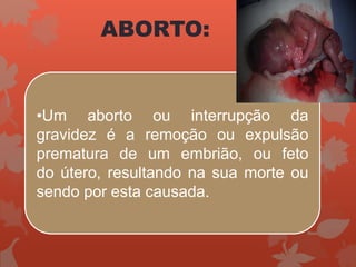 ABORTO:
•Um aborto ou interrupção da
gravidez é a remoção ou expulsão
prematura de um embrião, ou feto
do útero, resultando na sua morte ou
sendo por esta causada.
 