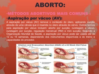 ABORTO:
•MÉTODOS ABORTIVOS MAIS COMUNS :
•Aspiração por vácuo (AV):
A aspiração por vácuo (AV) remove o conteúdo do útero, aplicando sucção
através de uma cânula que é inserida no útero através do cérvix. Outros termos
para aspiração por vácuo incluem: aborto por sucção, curetagem a vácuo,
curetagem por sucção, regulação menstrual (RM) e mini sucção. Segundo a
Organização Mundial de Saúde, a aspiração por vácuo pode ser usada até às
12 ou 15 semanas, dependendo dos instrumentos disponíveis e do treino e
capacidades do provedor.
 