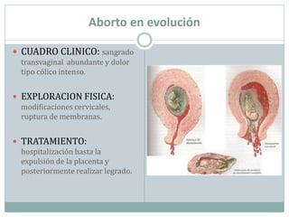 Aborto en evolución 
 CUADRO CLINICO: sangrado 
transvaginal abundante y dolor 
tipo cólico intenso. 
 EXPLORACION FISICA: 
modificaciones cervicales, 
ruptura de membranas. 
 TRATAMIENTO: 
hospitalización hasta la 
expulsión de la placenta y 
posteriormente realizar legrado. 
 